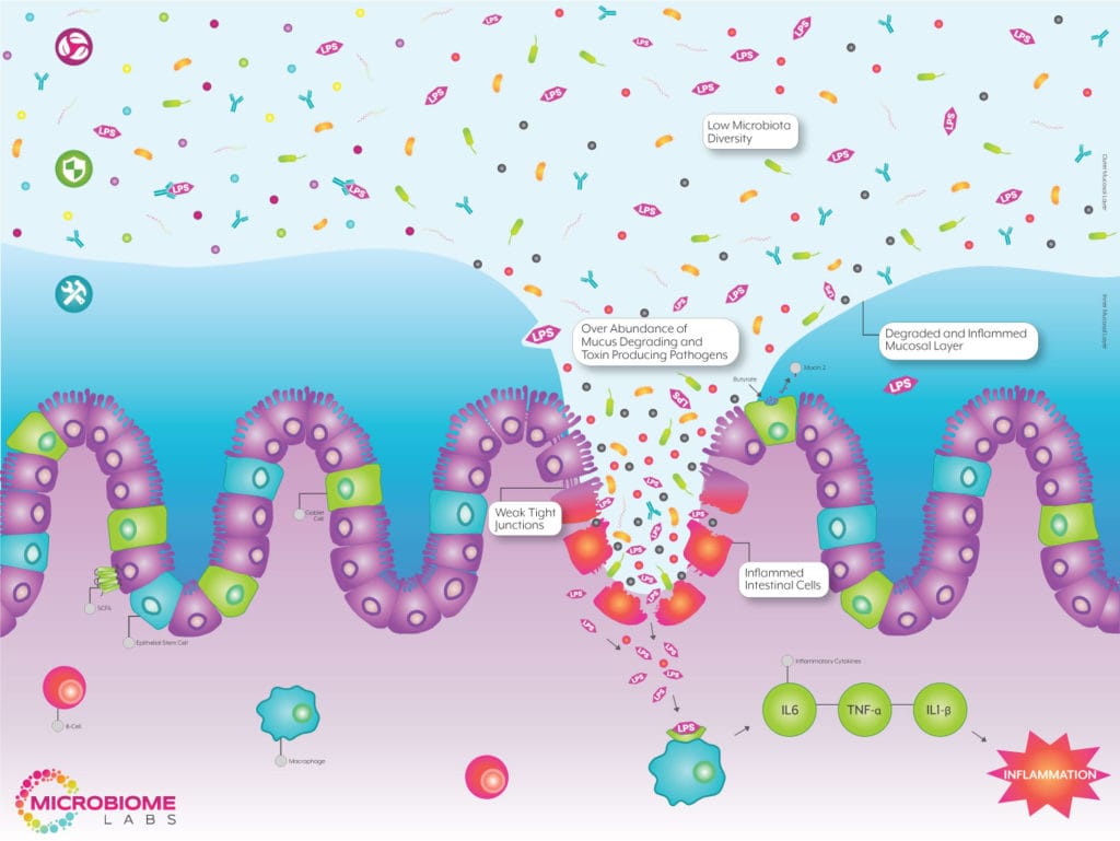 microbiomelabs-leakygut-model-1